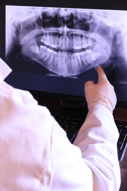 Best Emergency Denture Repair in Aurora, IL